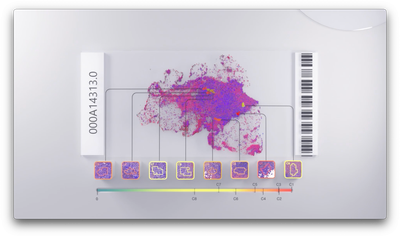 Waiv, formerly Owkin Dx